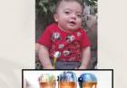 El pequeño Liam tendrá su casco ortopédico gracias a la solidaridad de la comunidad rosaleña
