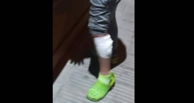 Un menor de edad fue asistido en el Hospital tras un ataque de perros