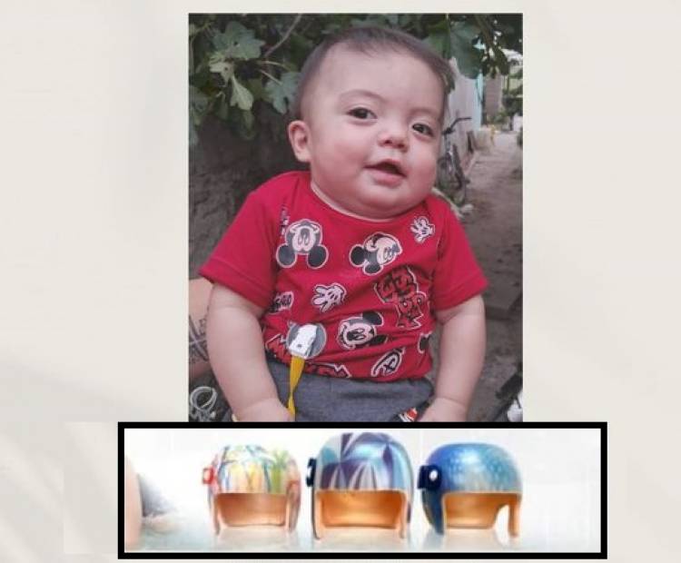 El pequeño Liam tendrá su casco ortopédico gracias a la solidaridad de la comunidad rosaleña