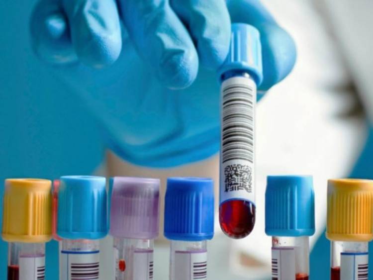 Todos los laboratorios de la Provincia de Buenos Aires suspendieron la atención por IOSFA